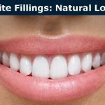 Dental Composite Fillings in Burbank
