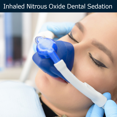 Sedation Dentistry Types Nitrous Oxide, Oral, Intravenous (IV) My