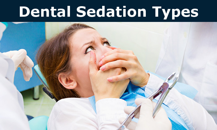 Sedation Dentistry Types: Nitrous Oxide, Oral, Intravenous (IV) | My ...