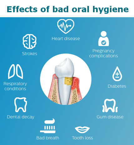 Dental Hygiene And Prophylaxis In Burbank My Dentist Burbank