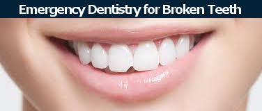 Broken tooth emergency dentostry