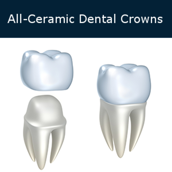 All Ceramic Crowns