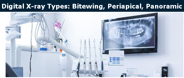 Digital X-ray Types: Bitewing, Periapical, Panoramic