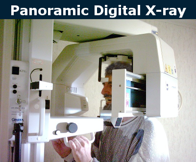 Panoramic X-Rays