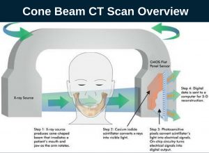 Cone Beam CT Scan Overview