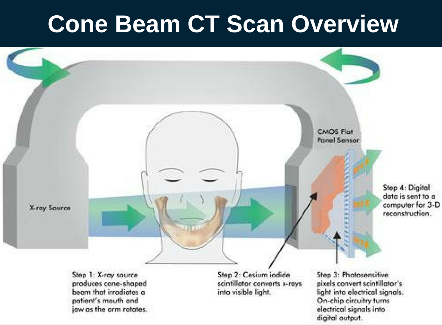 dental-cone-beam-ct-scan-burbank-my-dentist-burbank