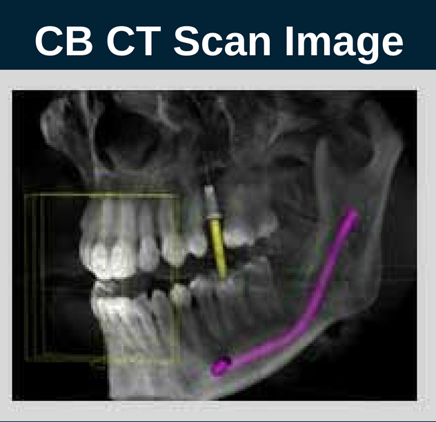 CB CT Scan Image