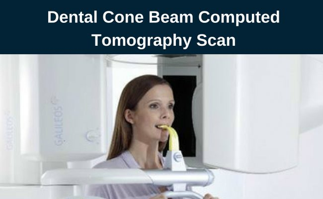 CT Scan for Dental Implants