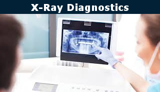 preventive dentistry x ray diagnostics