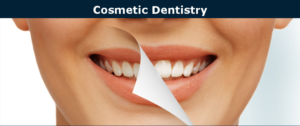 Cosmetic Dentistry