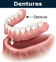 Dentures