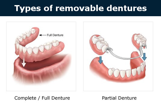 Dentures