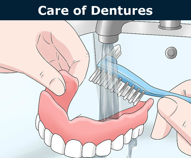 Care of dentures