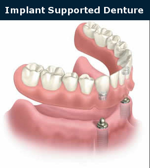 denture