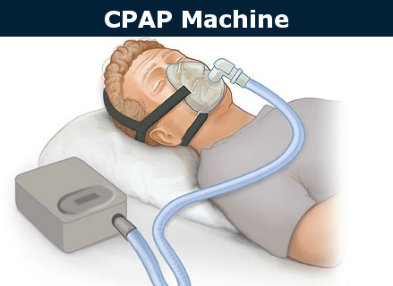 CPAP machine