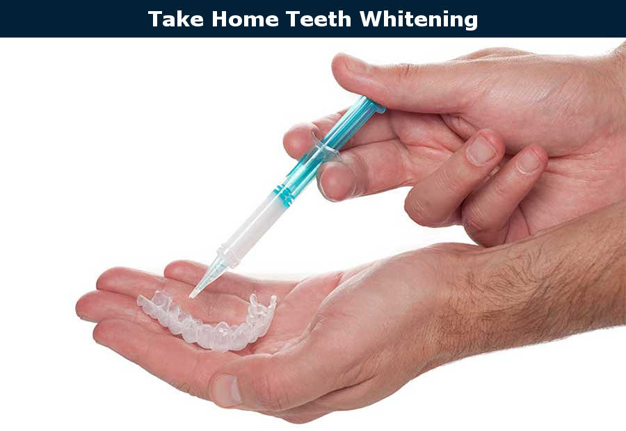 Take Home Teeth Whitening