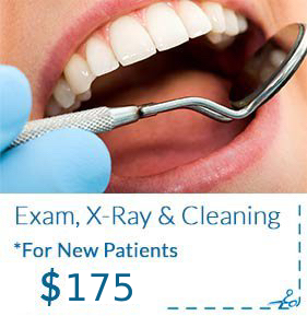 X-Ray & Cleaning Cost