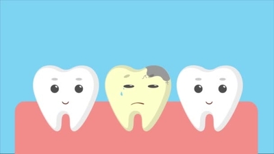 broken tooth