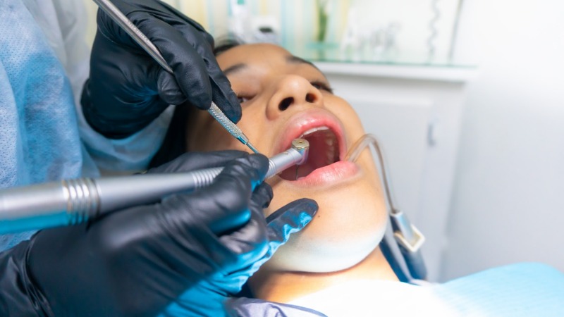 How to Care for Your Temporary Tooth Filling - Crest