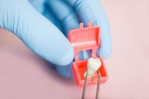 wisdom tooth