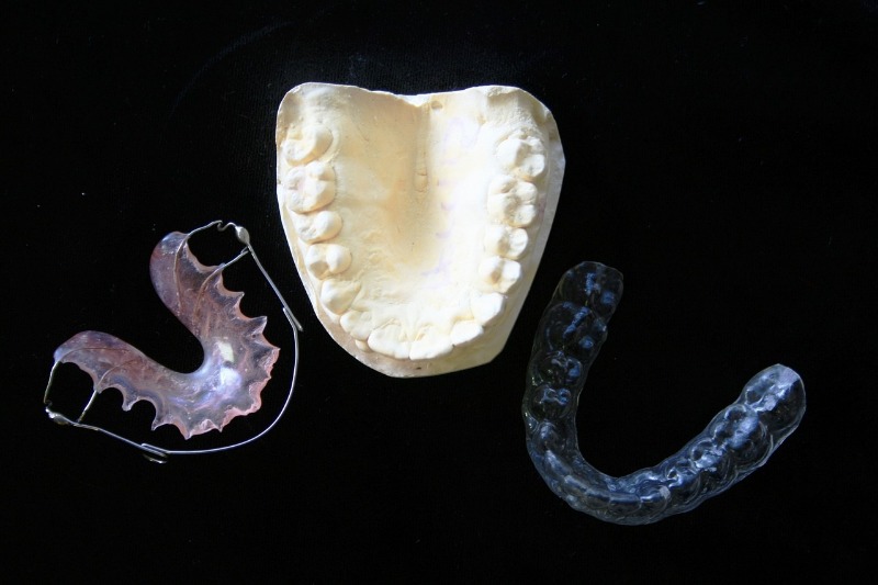 Invisalign vs. Braces: Which is Better