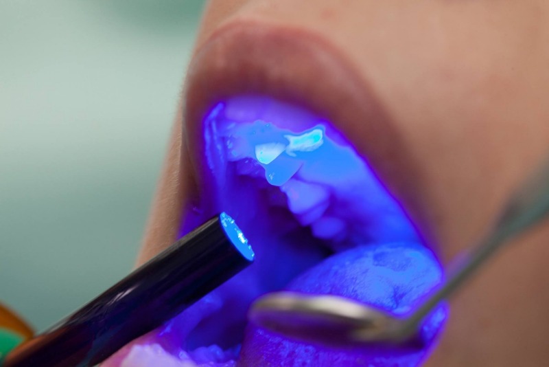 9 Popular Teeth Whitening Myths That Are Just Plain Wrong - My