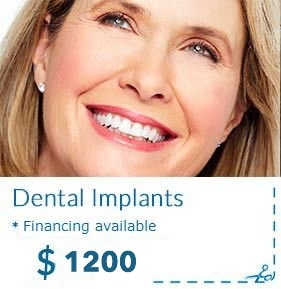 Dental Implants Cost
